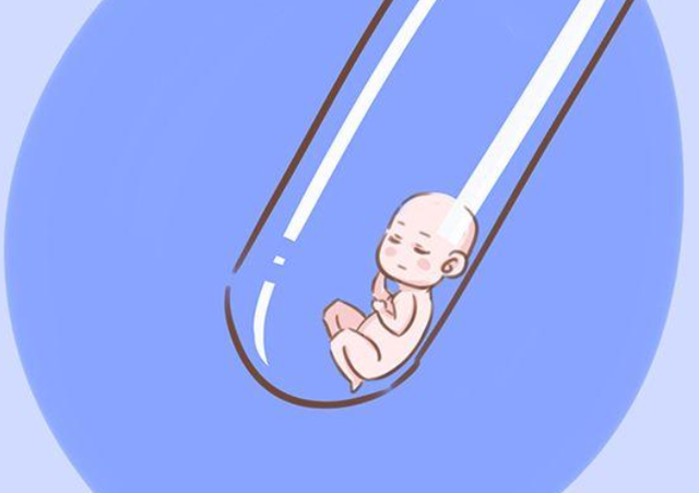 孕期护理