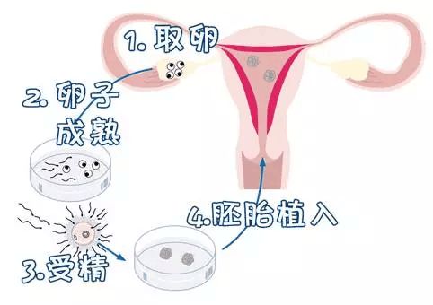 新生儿