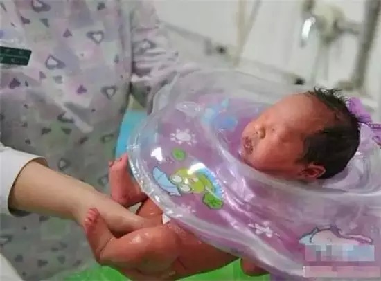新生儿全身发紫