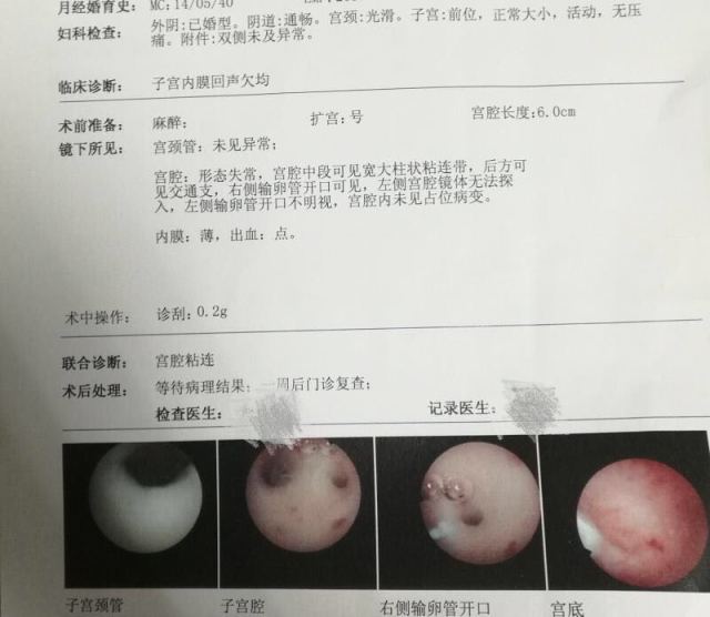 新生儿偶尔打喷嚏