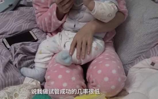 新生儿手脚发紫